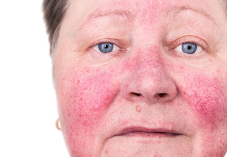 Причины обратиться к дерматологу для своевременного лечения кожных заболеваний