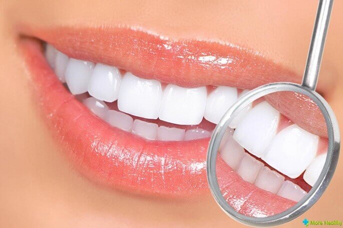 Как правильно ухаживать за зубами — секреты голливудской улыбки